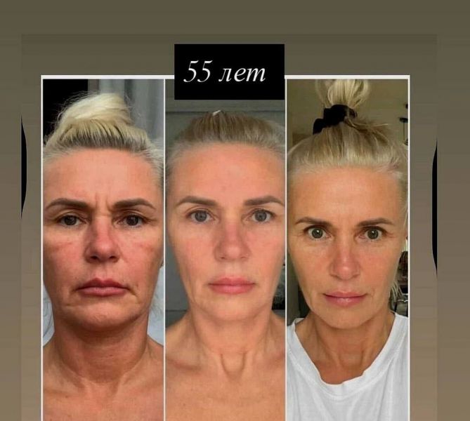 Ольга Верега hero image